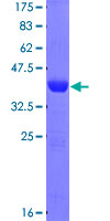 ab160053 on a 12.5% SDS-PAGE stained with Coomassie Blue.