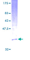 ab159167 on a 12.5% SDS-PAGE stained with Coomassie Blue.