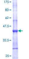 ab165191 on a 12.5% SDS-PAGE stained with Coomassie Blue.