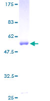 ab159168 on a 12.5% SDS-PAGE stained with Coomassie Blue.