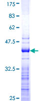 ab160051 on a 12.5% SDS-PAGE stained with Coomassie Blue.