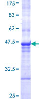 ab166241 on a 12.5% SDS-PAGE stained with Coomassie Blue.