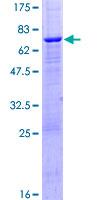 ab165655 on a 12.5% SDS-PAGE stained with Coomassie Blue.