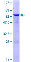 ab165634 on a 12.5% SDS-PAGE stained with Coomassie Blue.