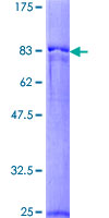 ab159169 on a 12.5% SDS-PAGE stained with Coomassie Blue.