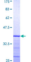 ab159170 on a 12.5% SDS-PAGE stained with Coomassie Blue.