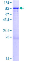 ab161884 on a 12.5% SDS-PAGE stained with Coomassie Blue.