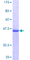 ab165623 on a 12.5% SDS-PAGE stained with Coomassie Blue.