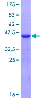 ab165624 on a 12.5% SDS-PAGE stained with Coomassie Blue.