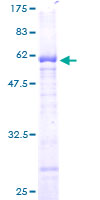 ab164065 on a 12.5% SDS-PAGE stained with Coomassie Blue.