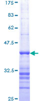 ab159171 on a 12.5% SDS-PAGE stained with Coomassie Blue.