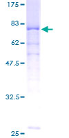 ab159172 on a 12.5% SDS-PAGE stained with Coomassie Blue.