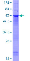 ab163251 on a 12.5% SDS-PAGE stained with Coomassie Blue.