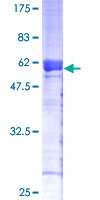 ab162160 on a 12.5% SDS-PAGE stained with Coomassie Blue.