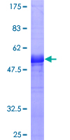 ab162161 on a 12.5% SDS-PAGE stained with Coomassie Blue.