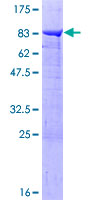 ab159173 on a 12.5% SDS-PAGE stained with Coomassie Blue.