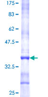 ab159174 on a 12.5% SDS-PAGE stained with Coomassie Blue.