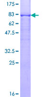 ab159175 on a 12.5% SDS-PAGE stained with Coomassie Blue.