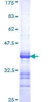 ab159176 on a 12.5% SDS-PAGE stained with Coomassie Blue.