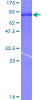 ab159177 on a 12.5% SDS-PAGE stained with Coomassie Blue.