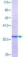 ab159178 on a 12.5% SDS-PAGE stained with Coomassie Blue.
