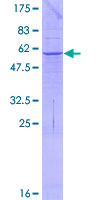 ab160458 on a 12.5% SDS-PAGE stained with Coomassie Blue.
