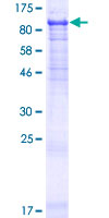ab161627 on a 12.5% SDS-PAGE stained with Coomassie Blue.