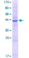 ab162882 on a 12.5% SDS-PAGE stained with Coomassie Blue.