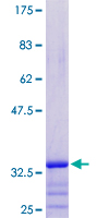 ab164583 on a 12.5% SDS-PAGE stained with Coomassie Blue.