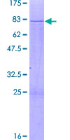 ab163839 on a 12.5% SDS-PAGE stained with Coomassie Blue.