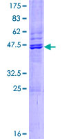 ab165142 on a 12.5% SDS-PAGE stained with Coomassie Blue.