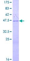 ab159180 on a 12.5% SDS-PAGE stained with Coomassie Blue.