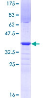 ab153158 on a 12.5% SDS-PAGE stained with Coomassie Blue.