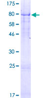 ab164145 on a 12.5% SDS-PAGE stained with Coomassie Blue.