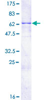 ab164974 on a 12.5% SDS-PAGE stained with Coomassie Blue.