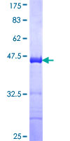 ab164975 on a 12.5% SDS-PAGE stained with Coomassie Blue.