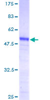 ab164087 on a 12.5% SDS-PAGE stained with Coomassie Blue.
