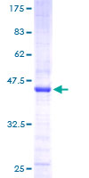 ab159224 on a 12.5% SDS-PAGE stained with Coomassie Blue.