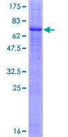 ab152637 on a 12.5% SDS-PAGE stained with Coomassie Blue.