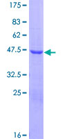 ab162468 on a 12.5% SDS-PAGE stained with Coomassie Blue.