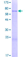 ab161844 on a 12.5% SDS-PAGE stained with Coomassie Blue.