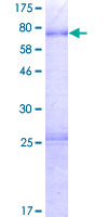 ab165545 on a 12.5% SDS-PAGE stained with Coomassie Blue.