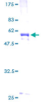 ab158154 on a 12.5% SDS-PAGE stained with Coomassie Blue.