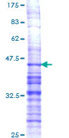 ab159086 on a 12.5% SDS-PAGE stained with Coomassie Blue.