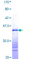 ab159105 on a 12.5% SDS-PAGE stained with Coomassie Blue.