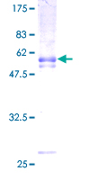 ab164739 on a 12.5% SDS-PAGE stained with Coomassie Blue.