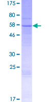 ab163685 on a 12.5% SDS-PAGE stained with Coomassie Blue.