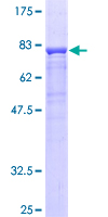 ab159094 on a 12.5% SDS-PAGE stained with Coomassie Blue.