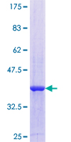 ab159067 on a 12.5% SDS-PAGE stained with Coomassie Blue.