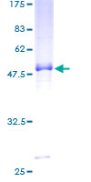 ab162833 on a 12.5% SDS-PAGE stained with Coomassie Blue.